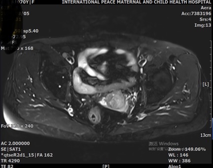 20251106395162.jpg c70b380a1c386d783b4c2b28f184b845.jpg